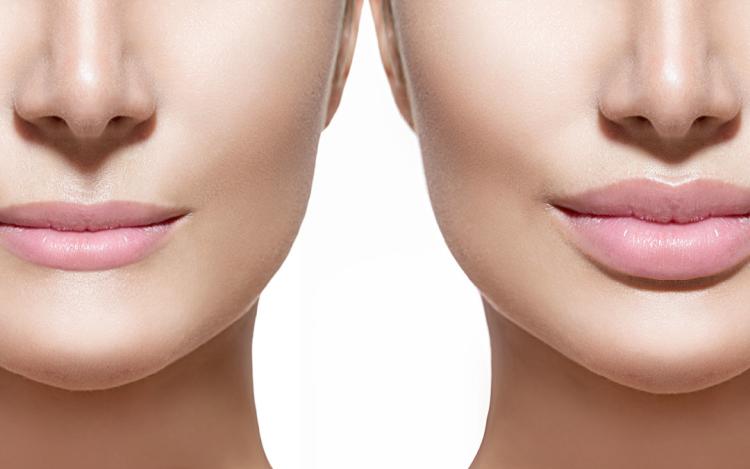 Pump Lip 4D Trattamento Filler Labbra All'Acido Ialuronico Effetto Volumizzante