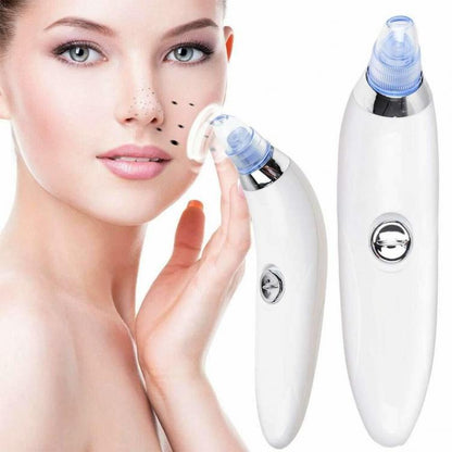 ASPIRATORE PUNTI NERI 4 TESTINE RIMUOVI PORI NASALI E ACNE VISO PULIZIA FACCIALE